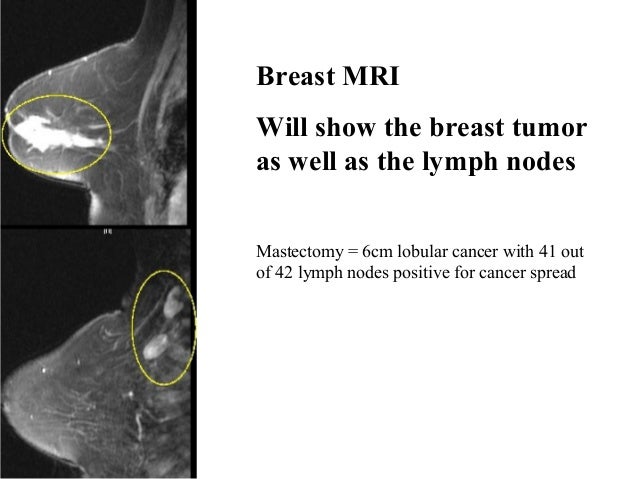 breast cancer cat scan Piss dripping out of her pussy